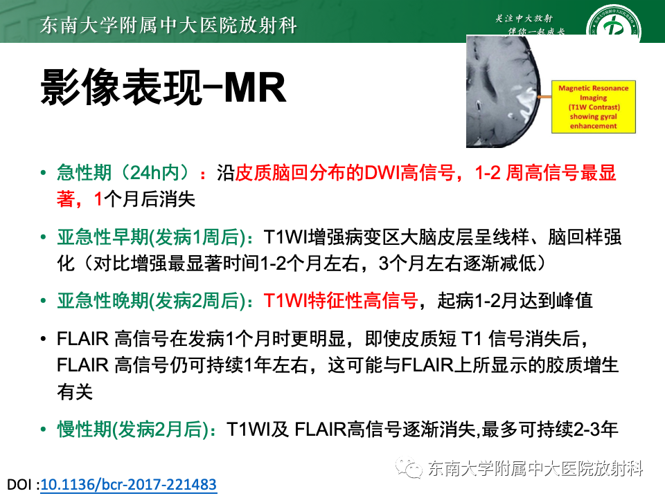 影像PPT - 【PPT】脑皮质层状坏死-14