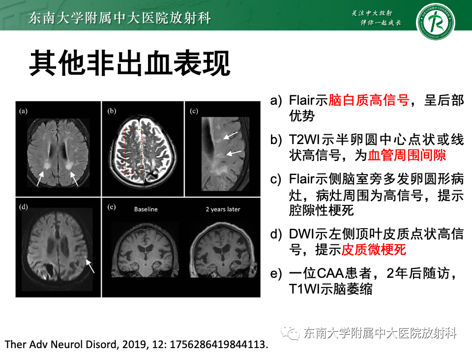 影像PPT - 【PPT】脑皮质层状坏死-29