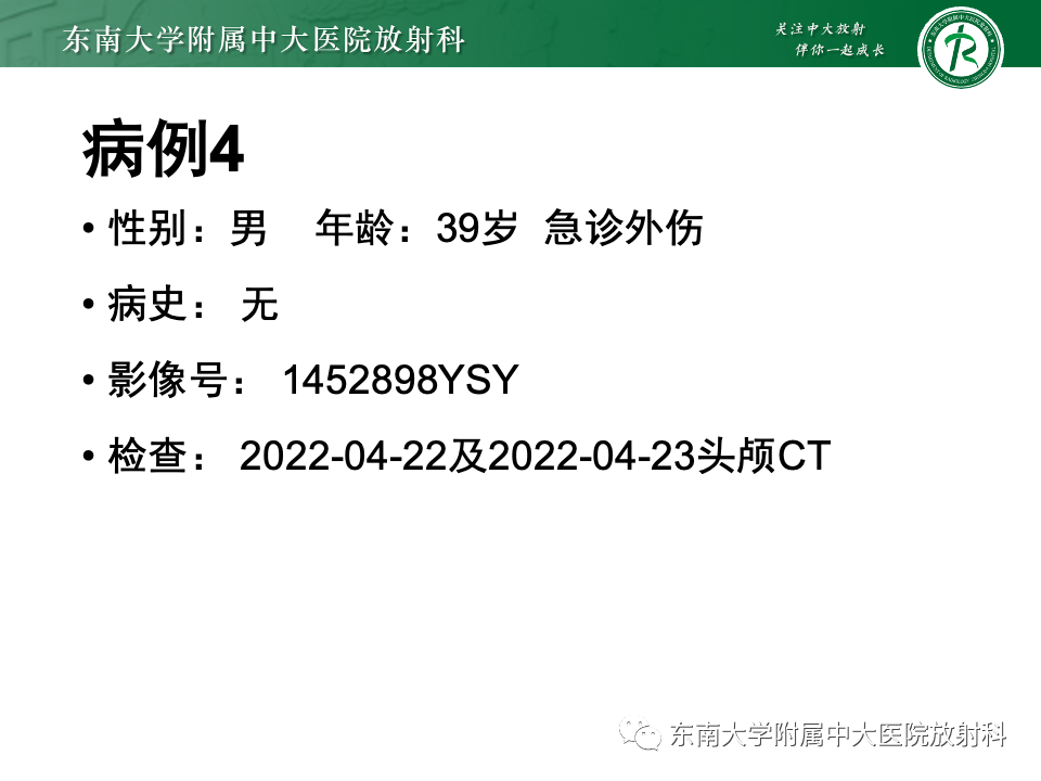 影像PPT - 【PPT】脑皮质层状坏死-31