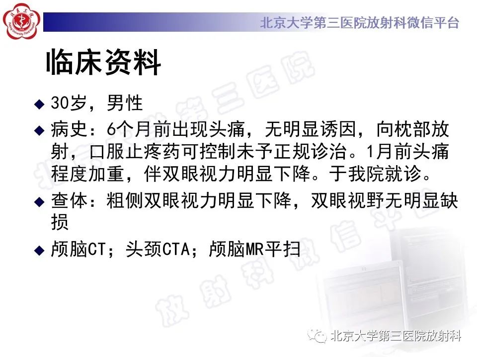 影像PPT - 【PPT】颅底脊索瘤-2