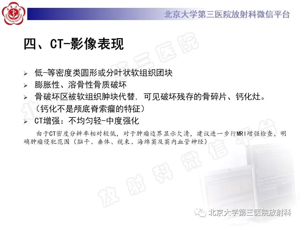 影像PPT - 【PPT】颅底脊索瘤-17
