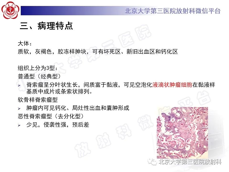 影像PPT - 【PPT】颅底脊索瘤-16