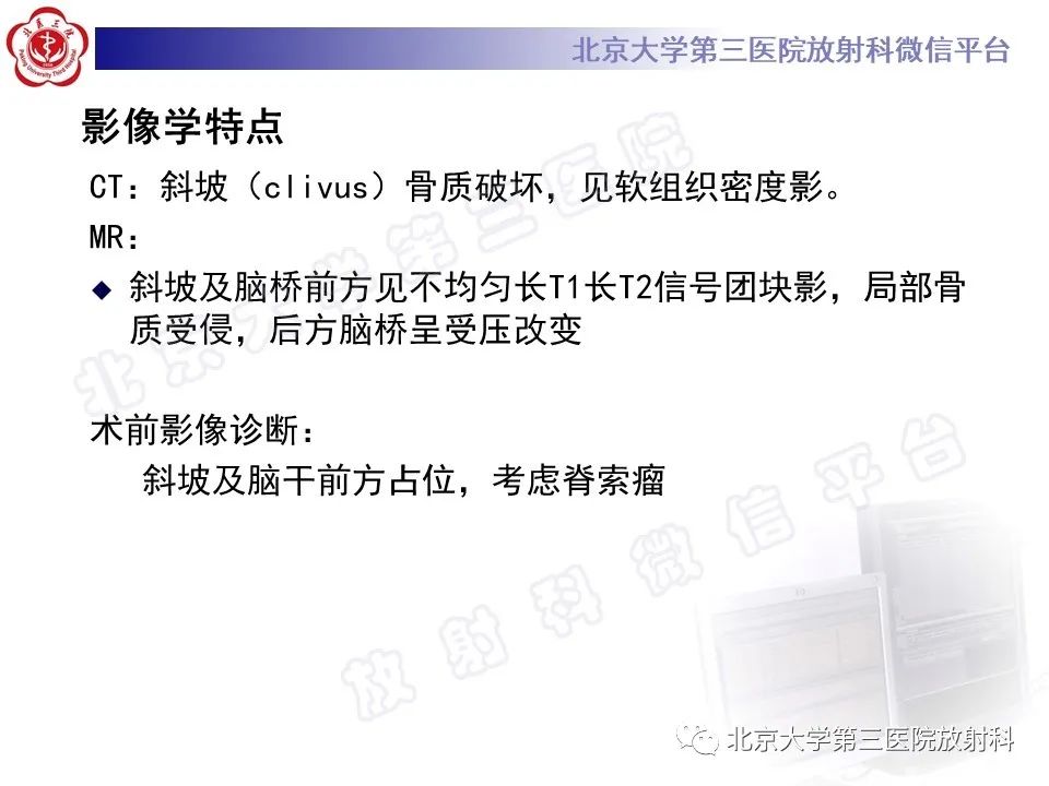 影像PPT - 【PPT】颅底脊索瘤-8
