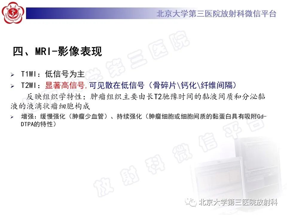 影像PPT - 【PPT】颅底脊索瘤-19