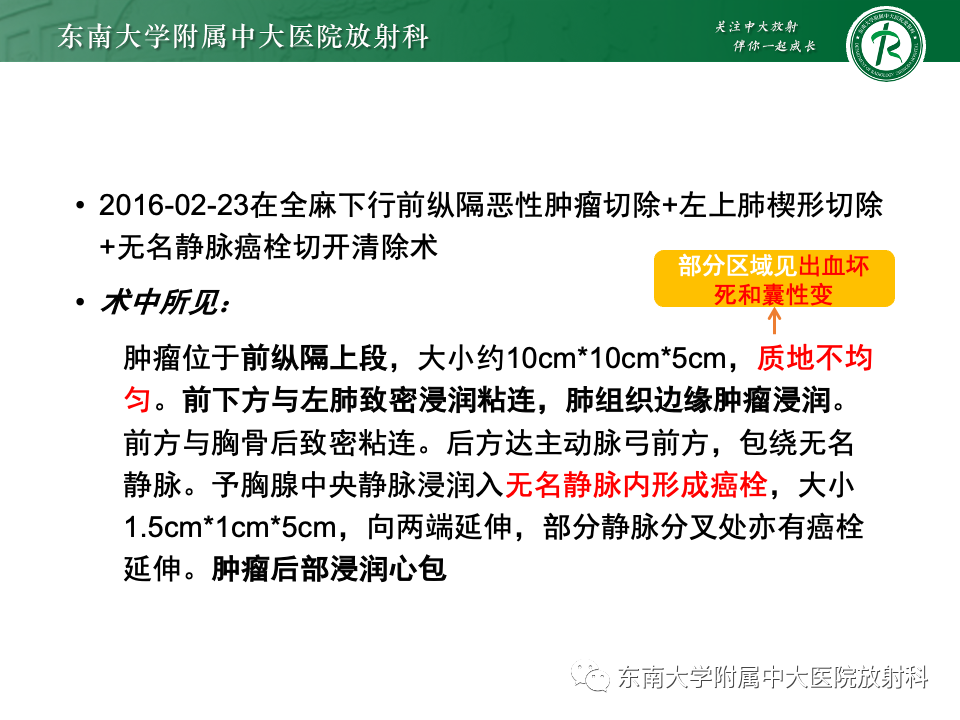 影像PPT - 【PPT】纵隔生殖细胞肿瘤-4 影像PPT - 【PPT】纵隔生殖细胞肿瘤-4