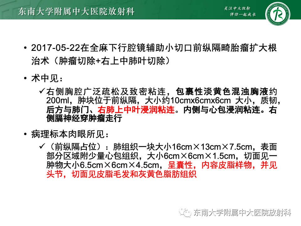 影像PPT - 【PPT】纵隔生殖细胞肿瘤-31 影像PPT - 【PPT】纵隔生殖细胞肿瘤-31