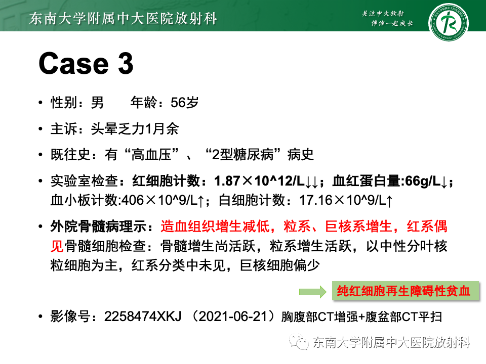 影像PPT - 【PPT】纵隔生殖细胞肿瘤-40 影像PPT - 【PPT】纵隔生殖细胞肿瘤-40