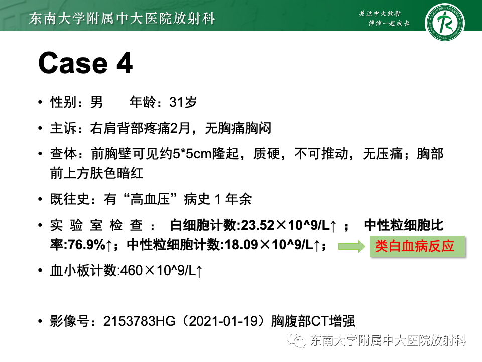 影像PPT - 【PPT】纵隔生殖细胞肿瘤-43 影像PPT - 【PPT】纵隔生殖细胞肿瘤-43