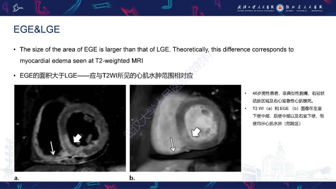 影像PPT - 【PPT】心脏MRI在急诊胸痛患者中的应用-31