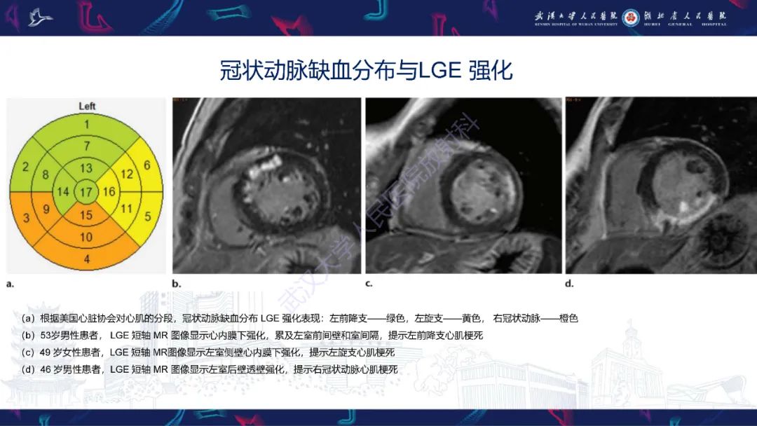 影像PPT - 【PPT】心脏MRI在急诊胸痛患者中的应用-34