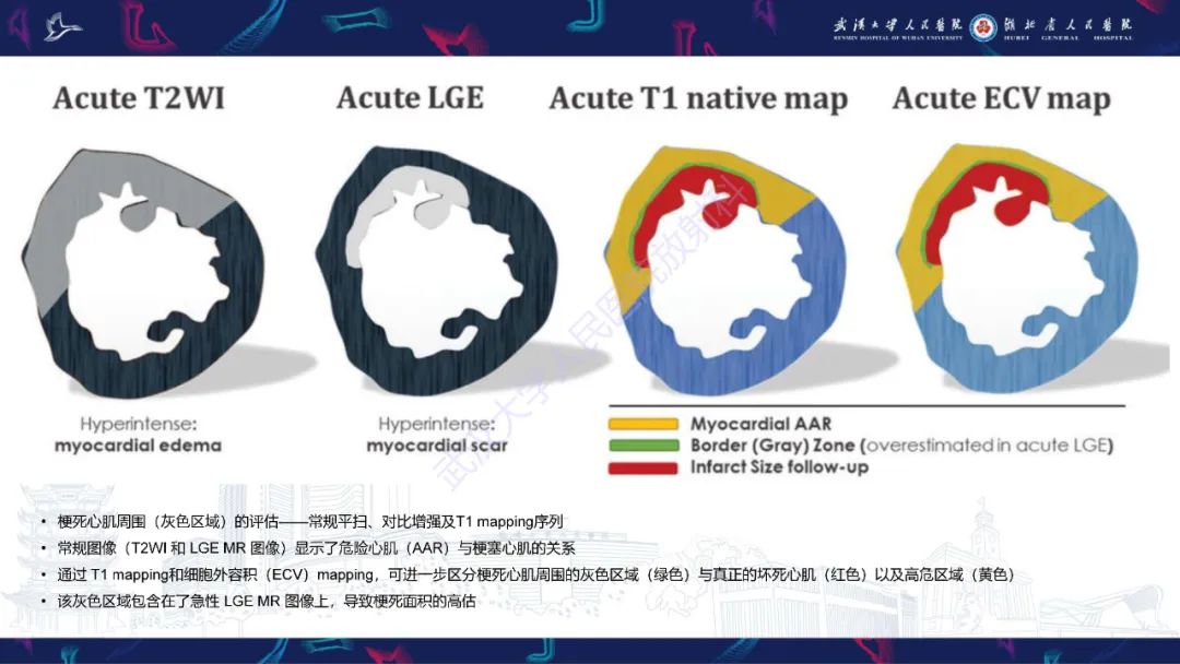 影像PPT - 【PPT】心脏MRI在急诊胸痛患者中的应用-36