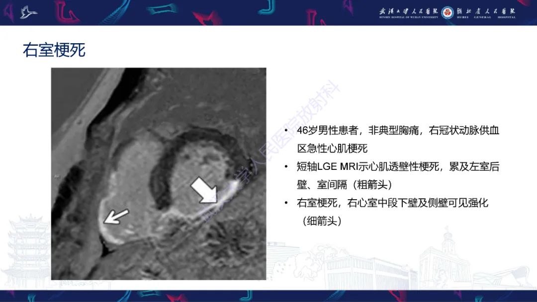 影像PPT - 【PPT】心脏MRI在急诊胸痛患者中的应用-49