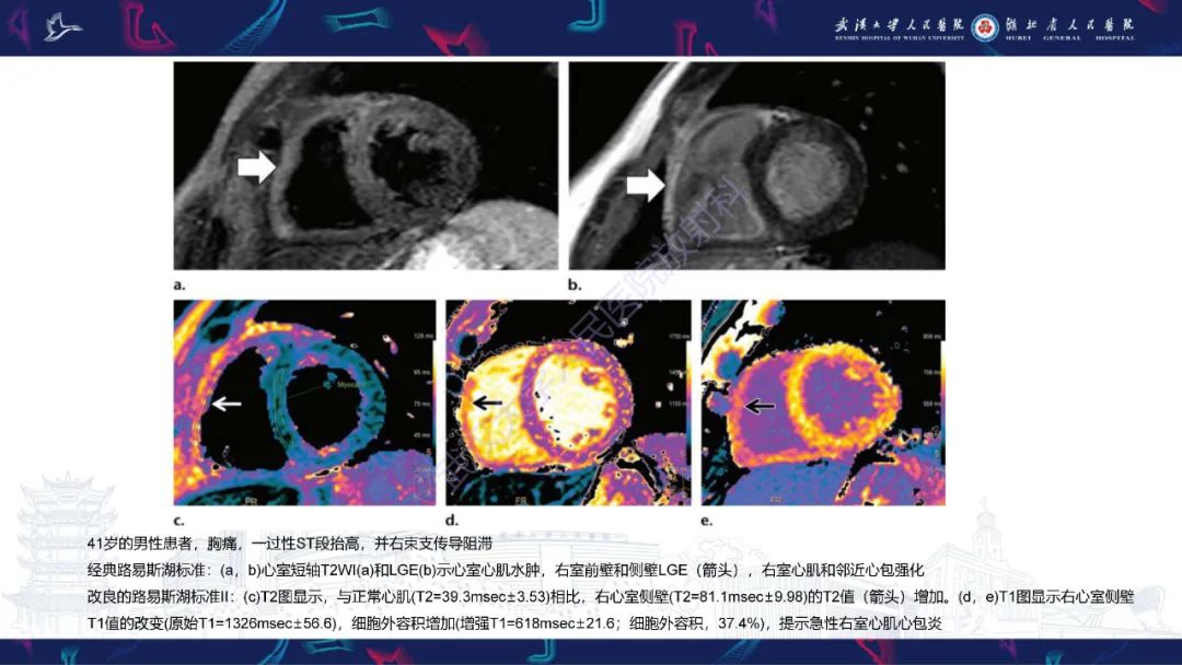 影像PPT - 【PPT】心脏MRI在急诊胸痛患者中的应用-65
