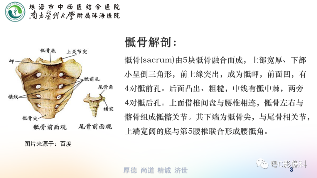 影像PPT - 【PPT】骶尾骨正侧位X线摄影-3