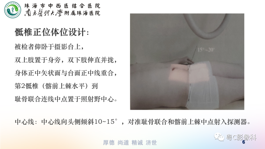 影像PPT - 【PPT】骶尾骨正侧位X线摄影-6