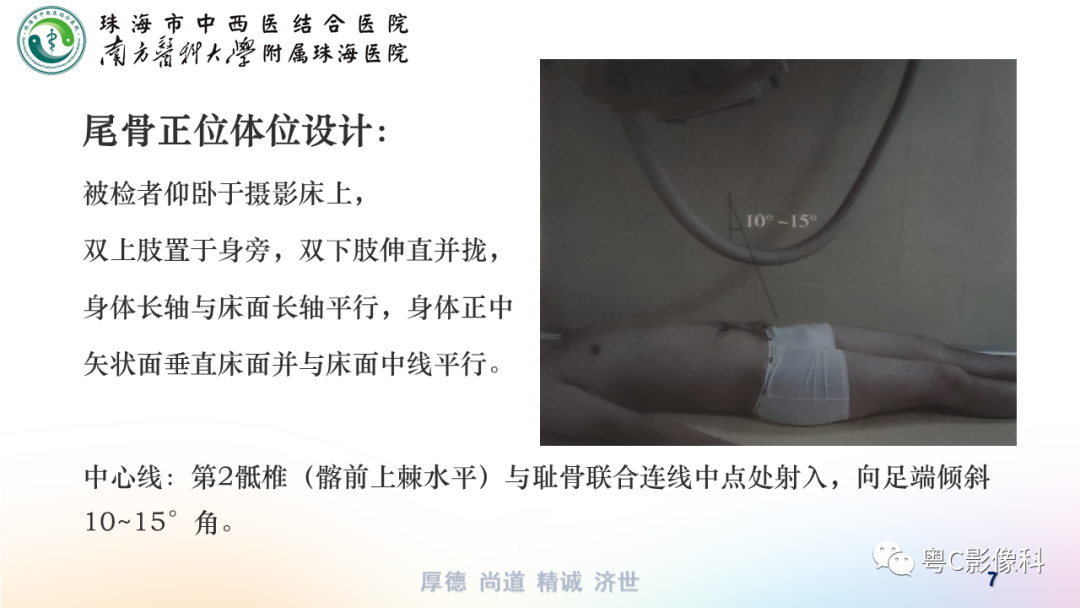 影像PPT - 【PPT】骶尾骨正侧位X线摄影-7