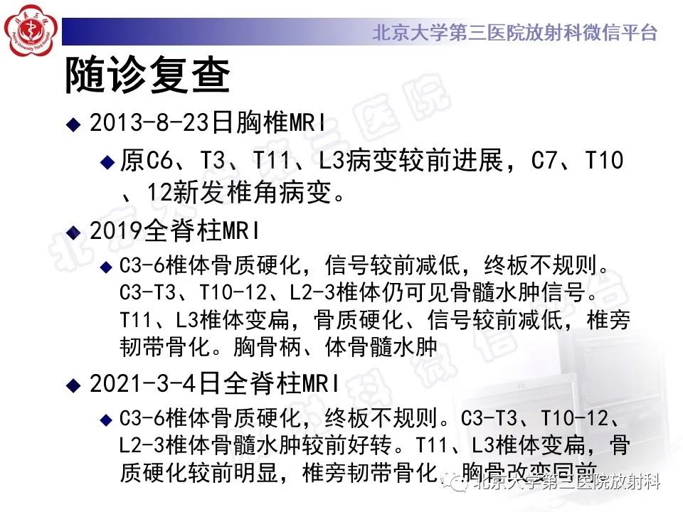 影像PPT - 【PPT】慢性复发性多灶性骨髓炎-13