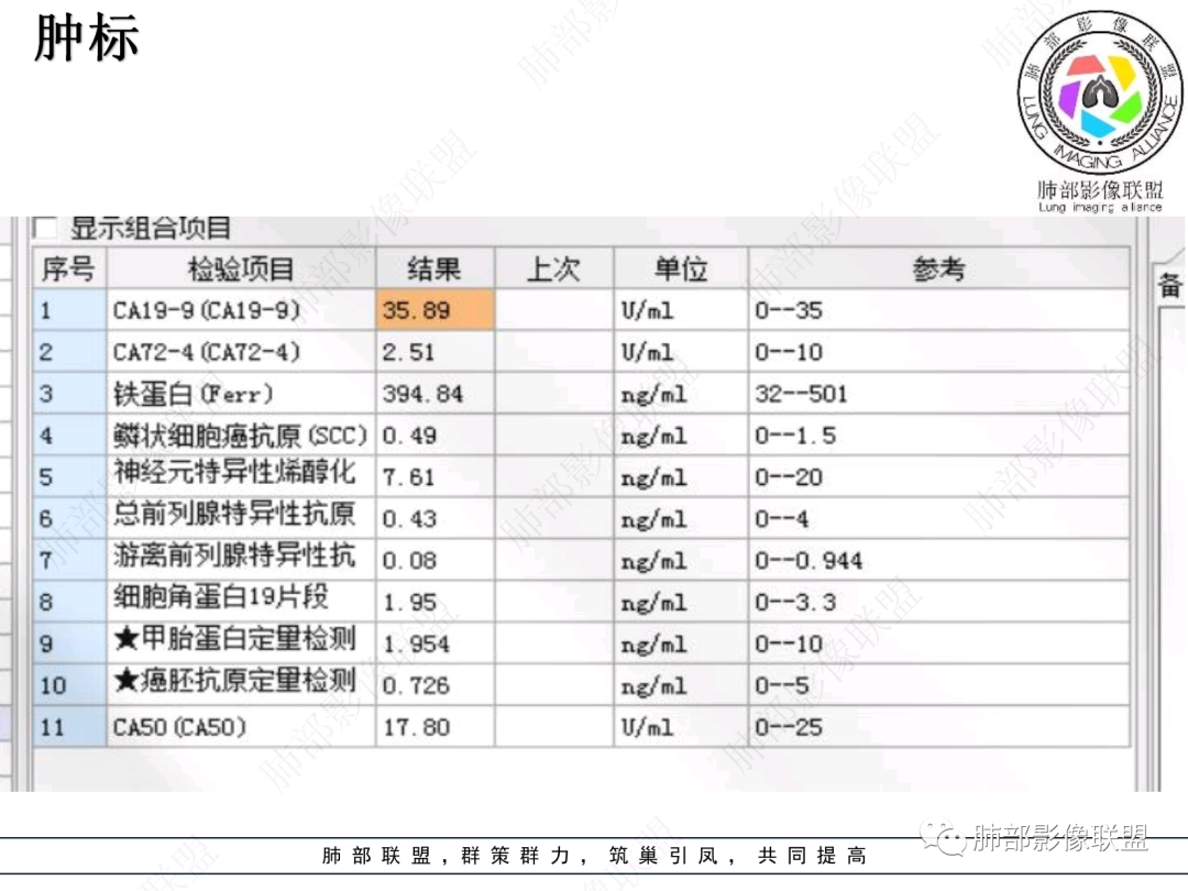 影像PPT - 【病例】支气管神经内分泌癌1例CT影像-5 影像PPT - 【病例】支气管神经内分泌癌1例CT影像-5