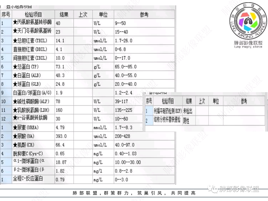 影像PPT - 【病例】支气管神经内分泌癌1例CT影像-4 影像PPT - 【病例】支气管神经内分泌癌1例CT影像-4