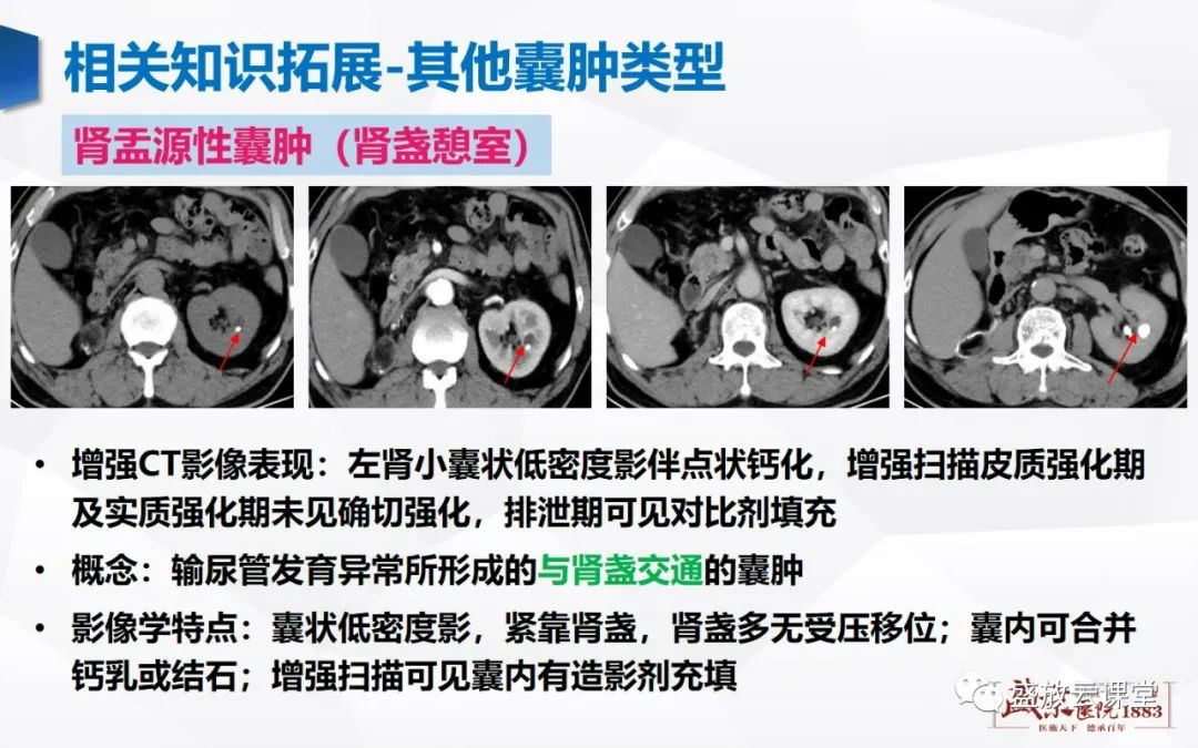 影像PPT - 【PPT】肾脏囊性病变-22 影像PPT - 【PPT】肾脏囊性病变-22
