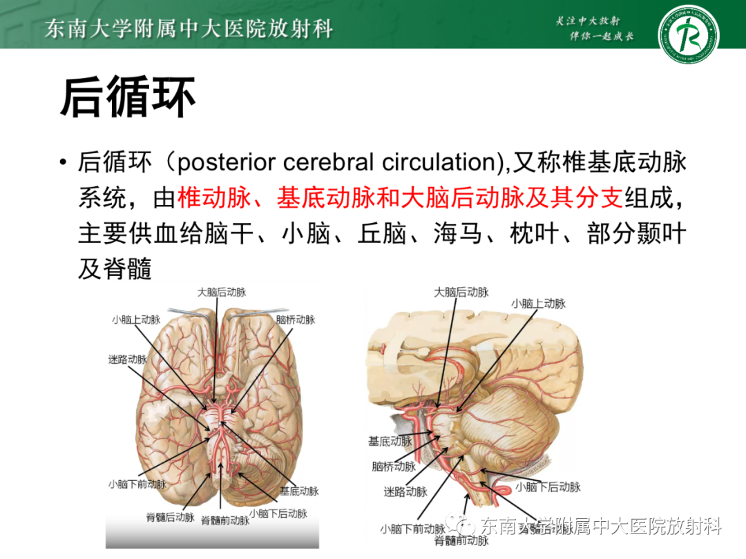 影像PPT - 【PPT】基底动脉尖综合征-10 影像PPT - 【PPT】基底动脉尖综合征-10