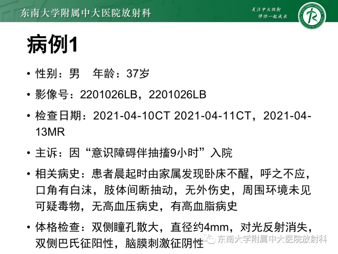 影像PPT - 【PPT】基底动脉尖综合征-5 影像PPT - 【PPT】基底动脉尖综合征-5