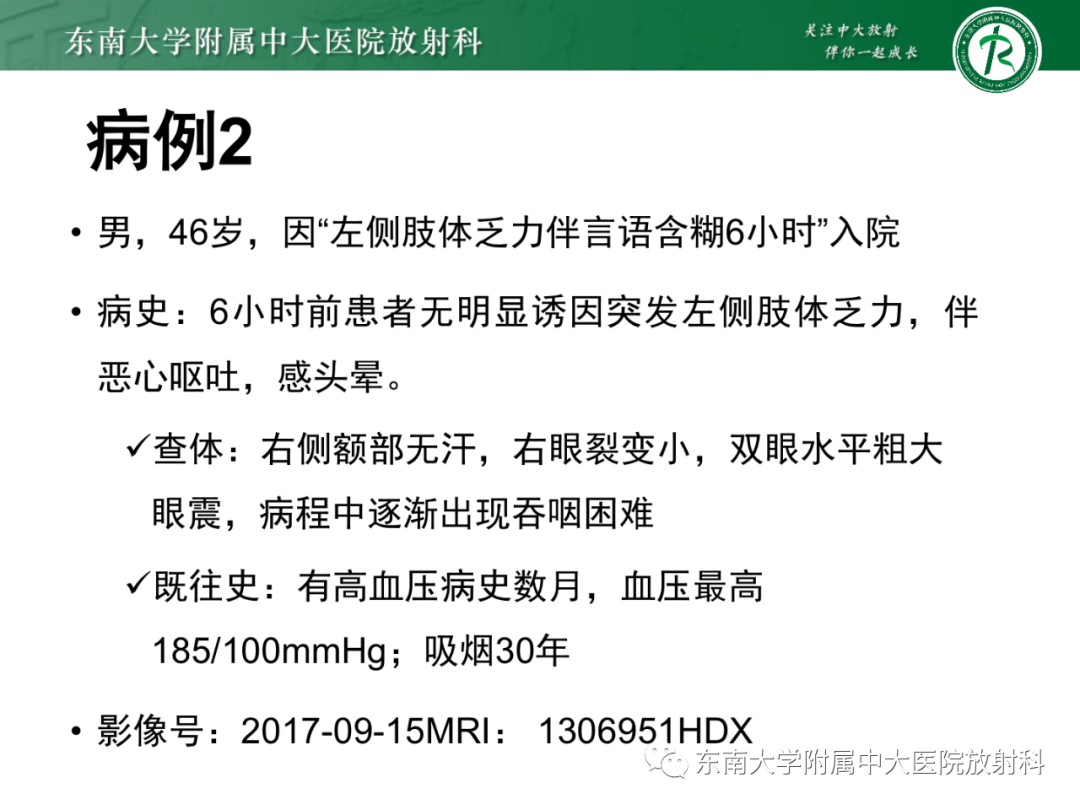 影像PPT - 【PPT】基底动脉尖综合征-27 影像PPT - 【PPT】基底动脉尖综合征-27