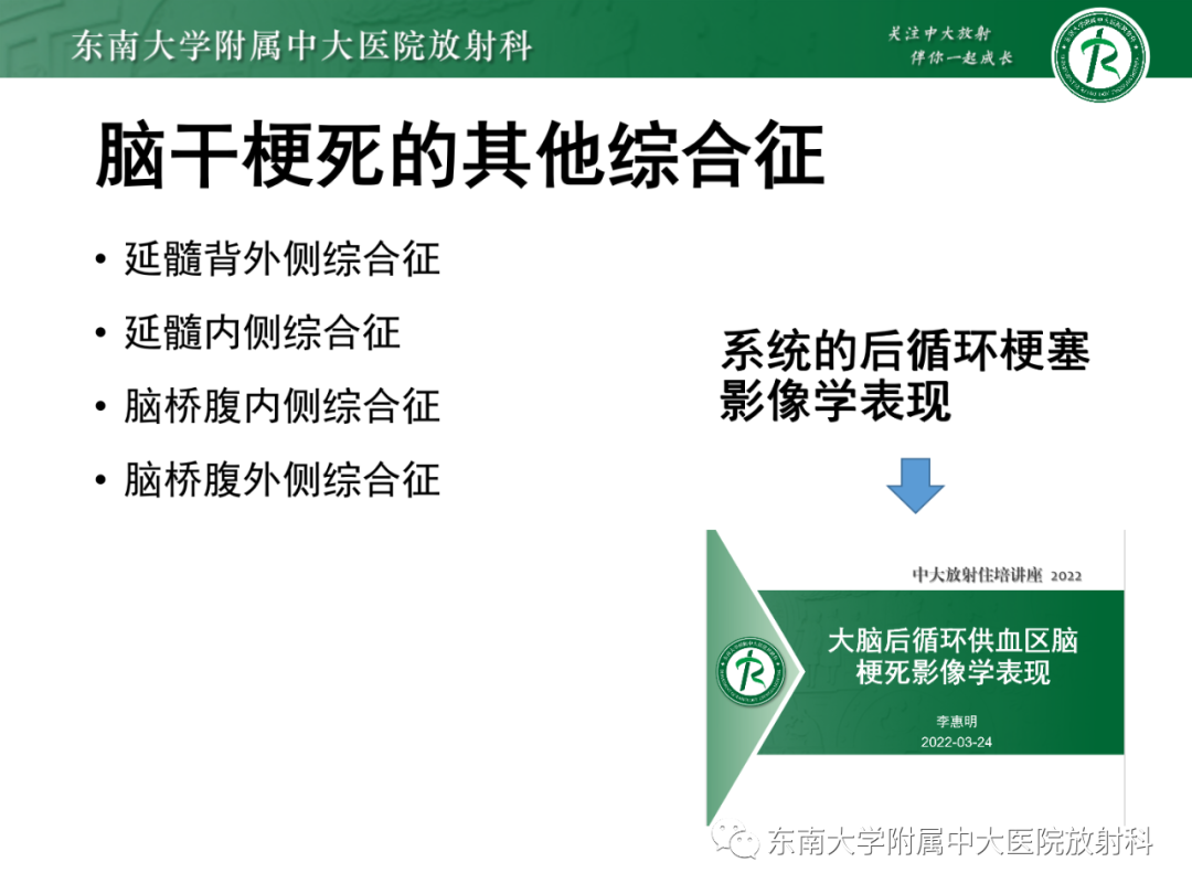 影像PPT - 【PPT】基底动脉尖综合征-25 影像PPT - 【PPT】基底动脉尖综合征-25