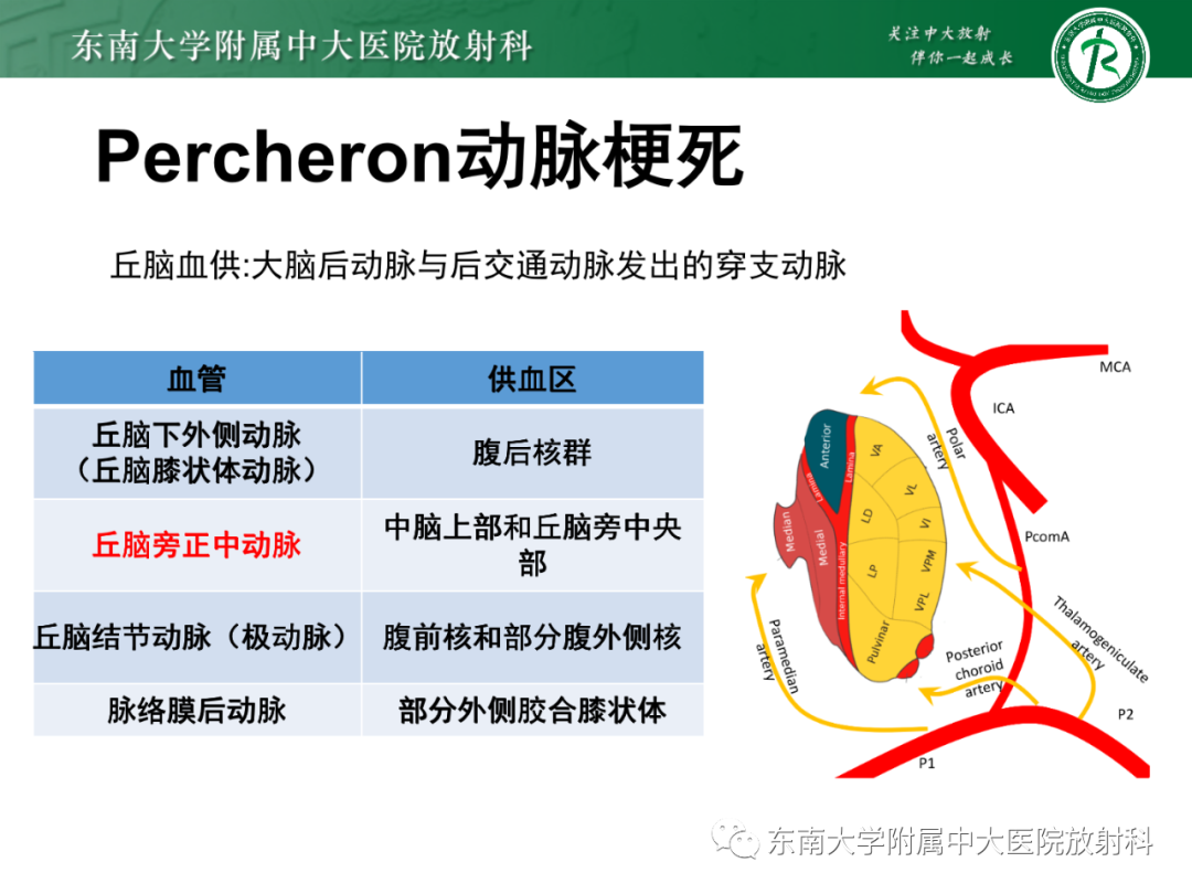 影像PPT - 【PPT】基底动脉尖综合征-20 影像PPT - 【PPT】基底动脉尖综合征-20