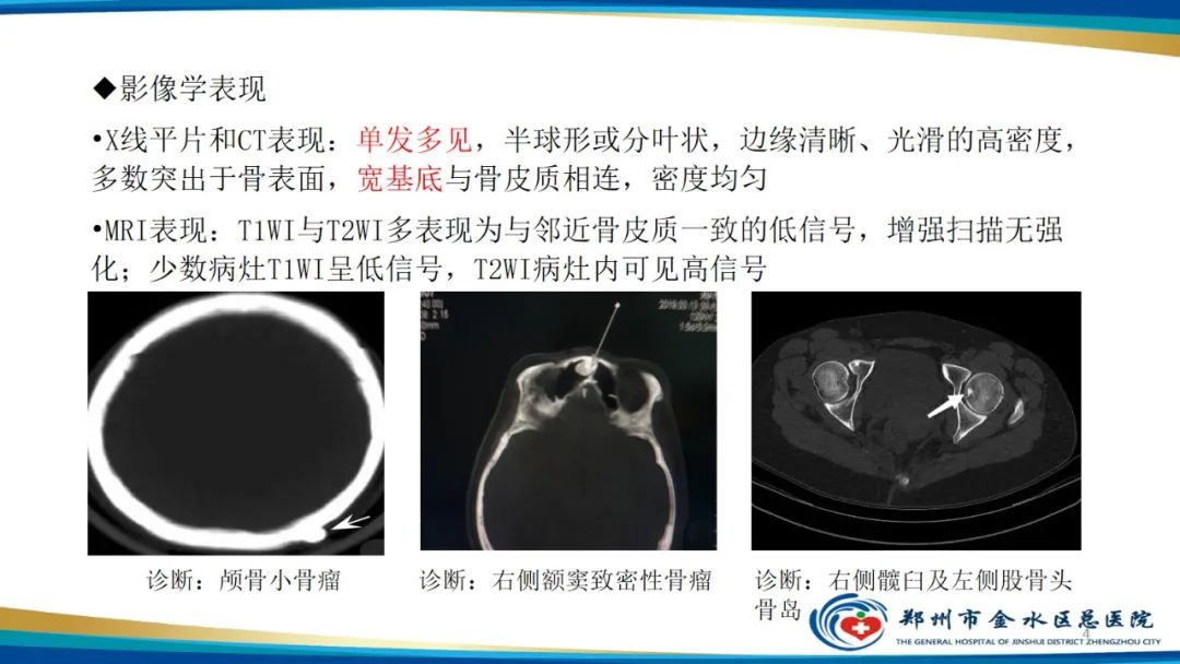 影像PPT - 【PPT】良性骨肿瘤的诊断及鉴别诊断-4