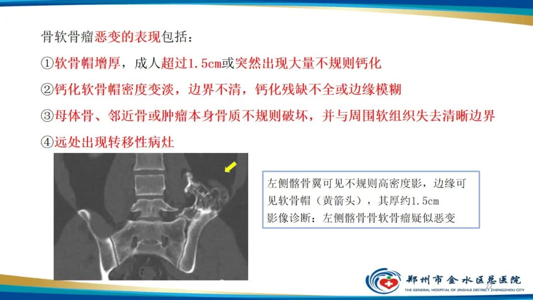 影像PPT - 【PPT】良性骨肿瘤的诊断及鉴别诊断-22
