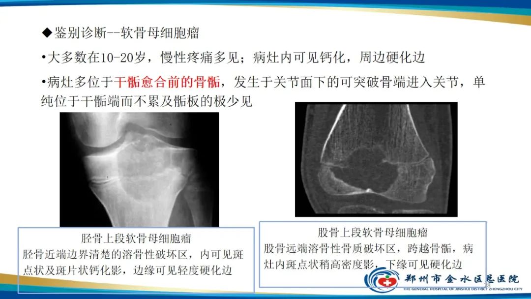 影像PPT - 【PPT】良性骨肿瘤的诊断及鉴别诊断-28