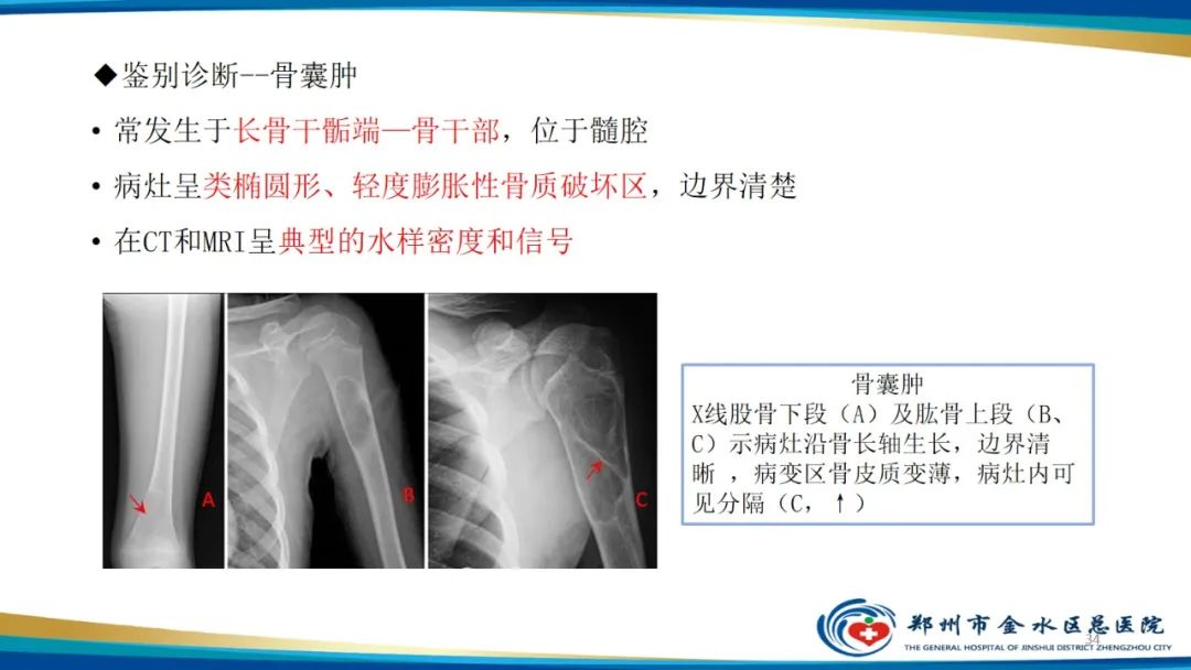 影像PPT - 【PPT】良性骨肿瘤的诊断及鉴别诊断-34