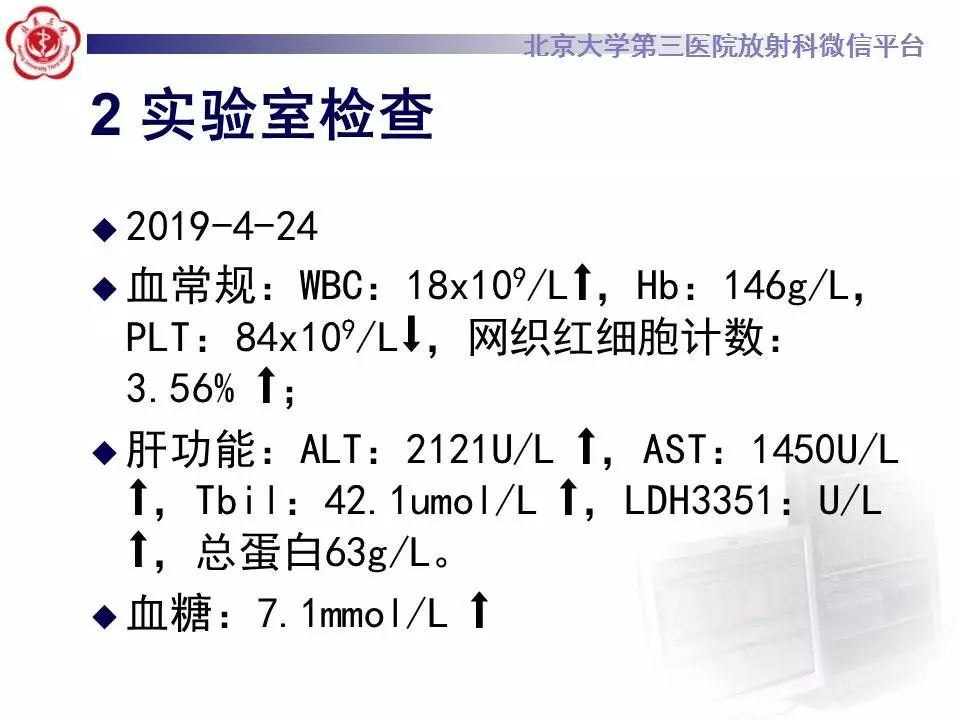 影像PPT - 【PPT】HELLP综合征肝脏影像学表现-3
