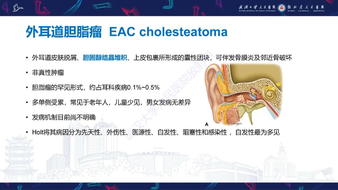 影像PPT - 【PPT】外耳道胆脂瘤影像诊断-6