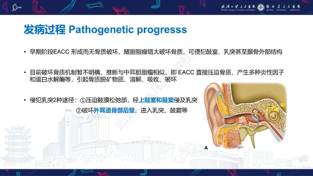 影像PPT - 【PPT】外耳道胆脂瘤影像诊断-7