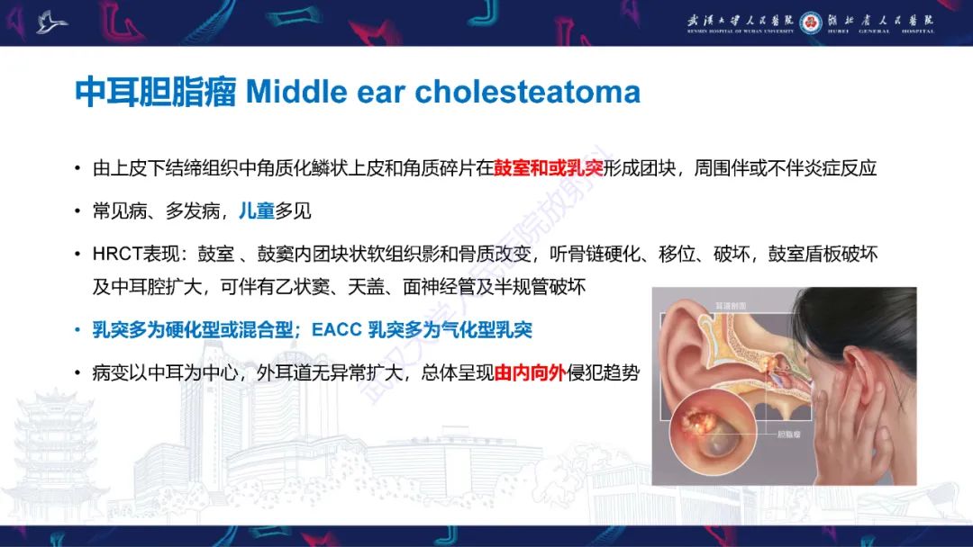 影像PPT - 【PPT】外耳道胆脂瘤影像诊断-21