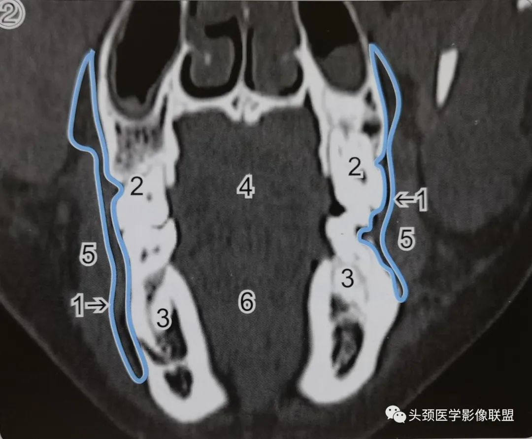 影像PPT - 口腔前庭影像解剖-2