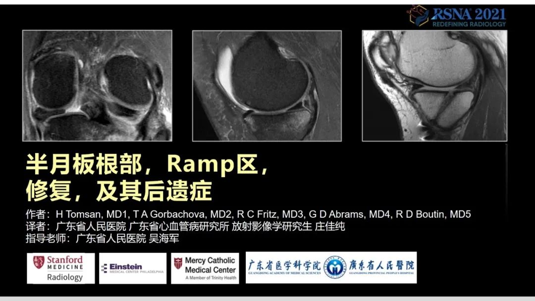 影像PPT - 【PPT】半月板根部,Ramp区,修复,及其后遗症-2 影像PPT - 【PPT】半月板根部,Ramp区,修复,及其后遗症-2