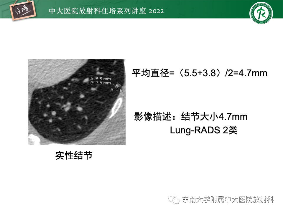 影像PPT - 【PPT】 肺Lung-RADS（V1.1）解读及临床应用要点-14