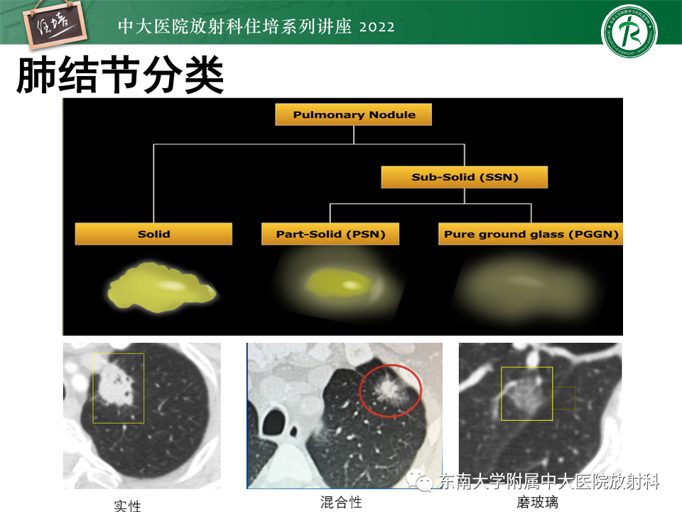 影像PPT - 【PPT】 肺Lung-RADS（V1.1）解读及临床应用要点-10