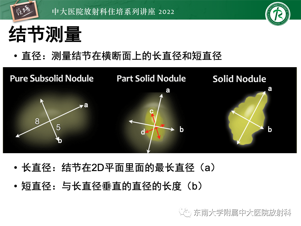 影像PPT - 【PPT】 肺Lung-RADS（V1.1）解读及临床应用要点-12
