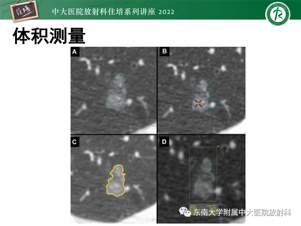 影像PPT - 【PPT】 肺Lung-RADS（V1.1）解读及临床应用要点-13