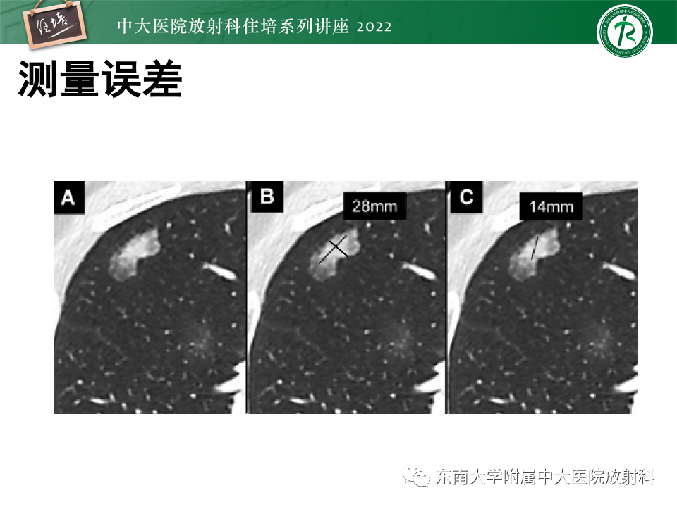 影像PPT - 【PPT】 肺Lung-RADS（V1.1）解读及临床应用要点-17