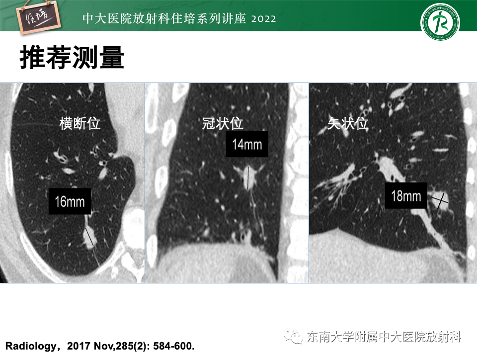 影像PPT - 【PPT】 肺Lung-RADS（V1.1）解读及临床应用要点-19