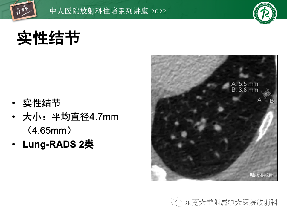 影像PPT - 【PPT】 肺Lung-RADS（V1.1）解读及临床应用要点-26