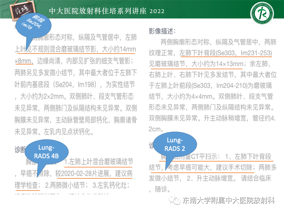 影像PPT - 【PPT】 肺Lung-RADS（V1.1）解读及临床应用要点-64