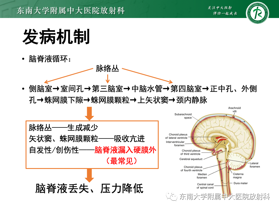 影像PPT - 【PPT】低颅压综合征的MRI表现-8 影像PPT - 【PPT】低颅压综合征的MRI表现-8