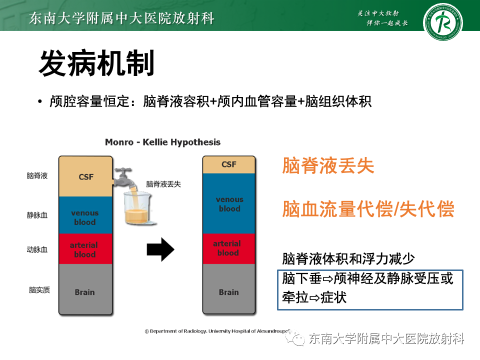 影像PPT - 【PPT】低颅压综合征的MRI表现-9 影像PPT - 【PPT】低颅压综合征的MRI表现-9