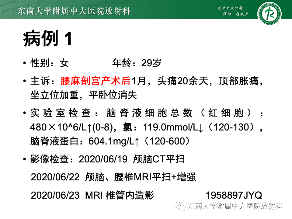 影像PPT - 【PPT】低颅压综合征的MRI表现-3 影像PPT - 【PPT】低颅压综合征的MRI表现-3